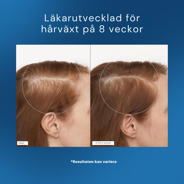 Mirakel Hårserum för Män